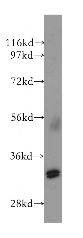 human small intestine tissue were subjected to SDS PAGE followed by western blot with Catalog No:116990(NHEJ1 antibody) at dilution of 1:300