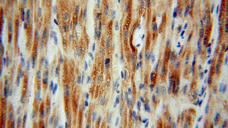 Immunohistochemical of paraffin-embedded human heart using Catalog No:109321(mitoNEET,CISD1 antibody) at dilution of 1:100 (under 40x lens)