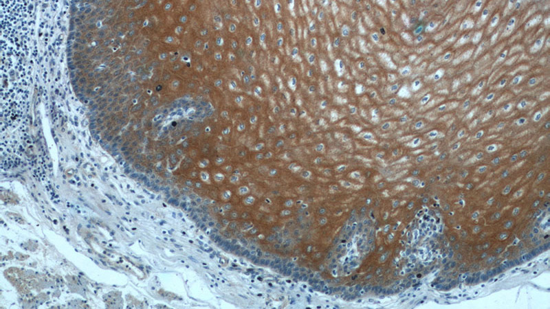 Immunohistochemistry of paraffin-embedded human oesophagus tissue slide using Catalog No:112169(LCE1A Antibody) at dilution of 1:50 (under 10x lens)