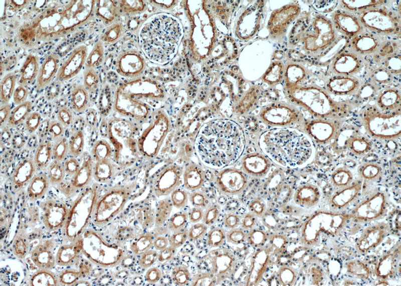 Immunohistochemical of paraffin-embedded human kidney using Catalog No:113659(PDE2A antibody) at dilution of 1:50 (under 10x lens)