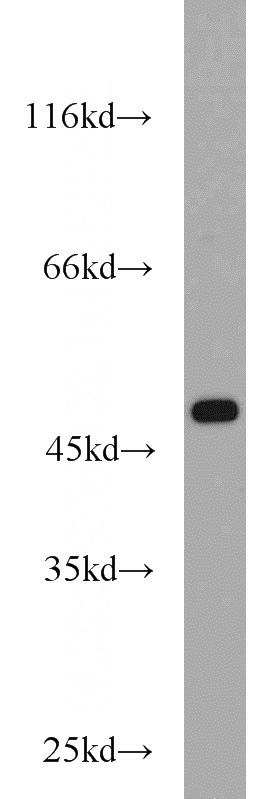 HeLa cells were subjected to SDS PAGE followed by western blot with Catalog No:110646(FH antibody) at dilution of 1:1000