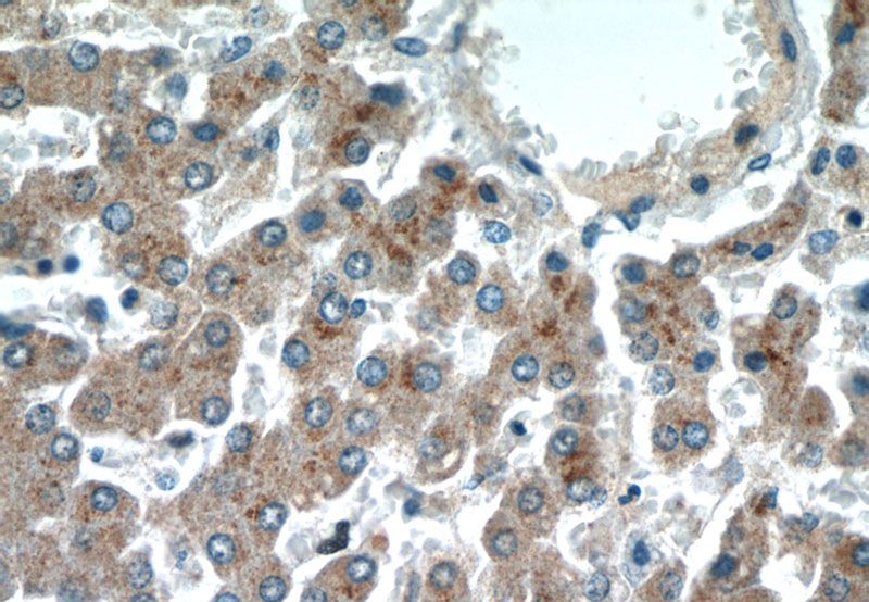 Immunohistochemical of paraffin-embedded human liver using Catalog No:113017(NAGS antibody) at dilution of 1:50 (under 40x lens)