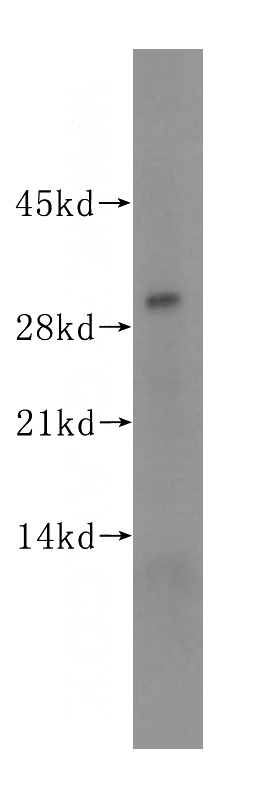 human placenta tissue were subjected to SDS PAGE followed by western blot with Catalog No:109564(CRISP3 antibody) at dilution of 1:300