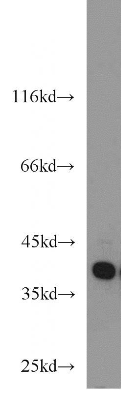 HeLa cells were subjected to SDS PAGE followed by western blot with Catalog No:111386(HDGF antibody) at dilution of 1:2000