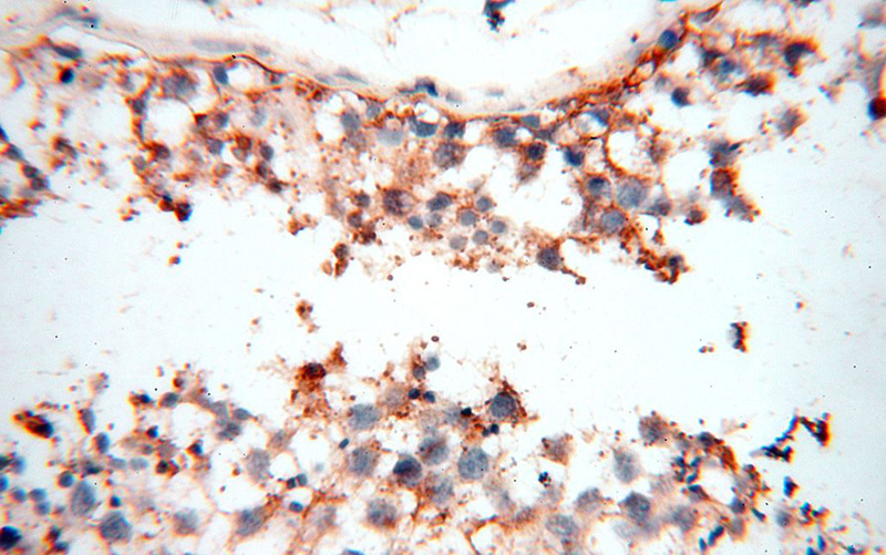 Immunohistochemical of paraffin-embedded human testis using Catalog No:116030(TGM4 antibody) at dilution of 1:100 (under 40x lens)