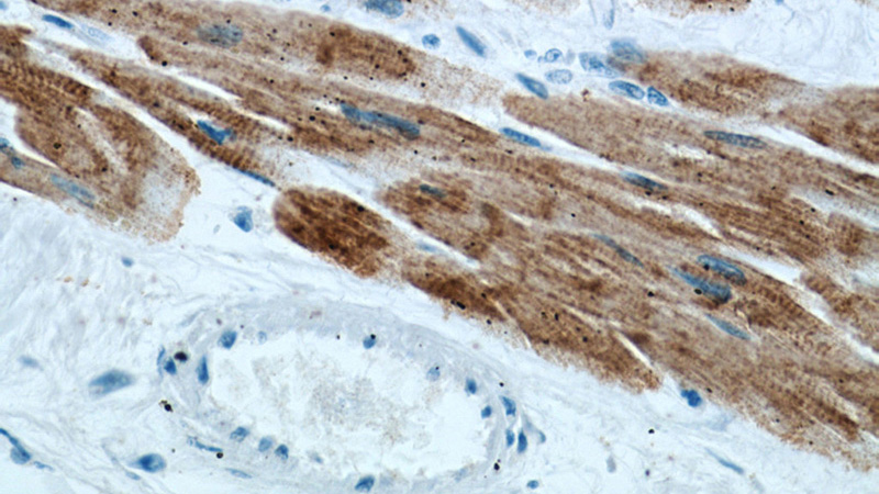 Immunohistochemical of paraffin-embedded human heart using Catalog No:107575(Actin-cardiac-muscle-1-Specific antibody) at dilution of 1:200 (under 40x lens)