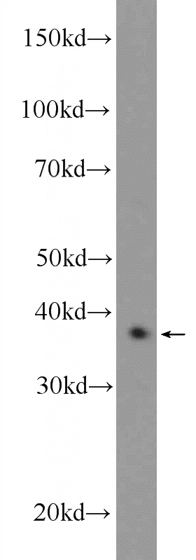 mouse brain tissue were subjected to SDS PAGE followed by western blot with Catalog No:109654(CXXC5 Antibody) at dilution of 1:600