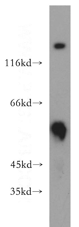 HeLa cells were subjected to SDS PAGE followed by western blot with Catalog No:113913(PIP4K2B antibody) at dilution of 1:800