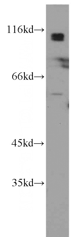 K-562 cells were subjected to SDS PAGE followed by western blot with Catalog No:117124(ADD2 antibody) at dilution of 1:1000
