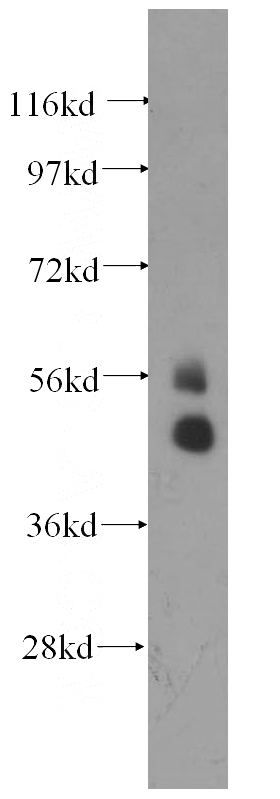 PC-3 cells were subjected to SDS PAGE followed by western blot with Catalog No:115891(TBX22 antibody) at dilution of 1:500