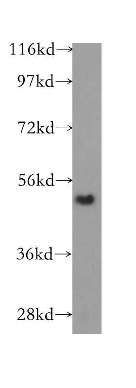 human placenta tissue were subjected to SDS PAGE followed by western blot with Catalog No:116059(TINAGL1 antibody) at dilution of 1:800