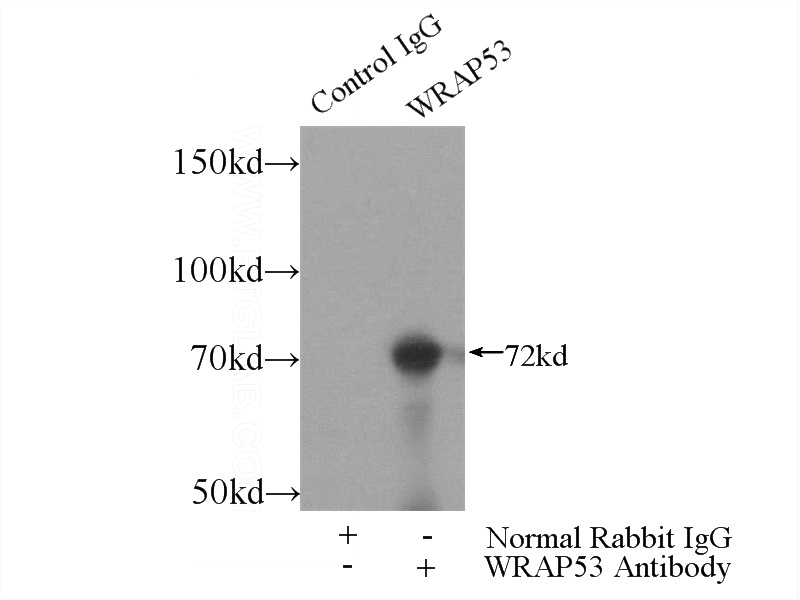 IP Result of anti-WRAP53 (IP:Catalog No:116839, 4ug; Detection:Catalog No:116839 1:300) with HeLa cells lysate 2480ug.