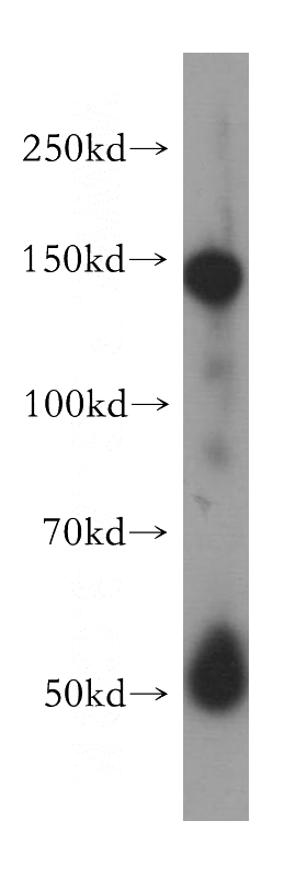 human heart tissue were subjected to SDS PAGE followed by western blot with Catalog No:115544(SPARCL1 antibody) at dilution of 1:400