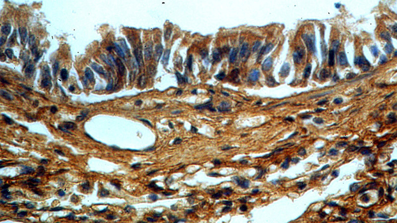 Immunohistochemical of paraffin-embedded human lung using Catalog No:112619(MIF antibody) at dilution of 1:100 (under 40x lens)