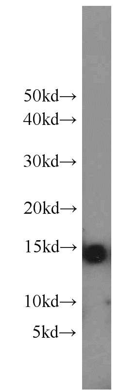 rat skeletal muscle tissue were subjected to SDS PAGE followed by western blot with Catalog No:109785(CYCS antibody) at dilution of 1:800