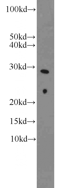 mouse kidney tissue were subjected to SDS PAGE followed by western blot with Catalog No:115441(SNAI1 antibody) at dilution of 1:1000