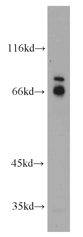 Jurkat cells were subjected to SDS PAGE followed by western blot with Catalog No:108964(CCDC120 antibody) at dilution of 1:500