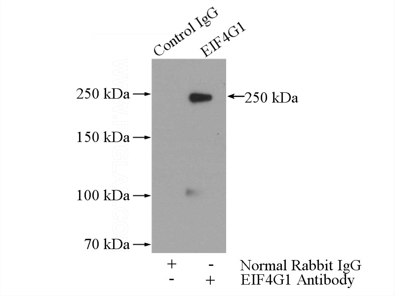 IP Result of anti-EIF4G1 (IP:Catalog No:110263, 5ug; Detection:Catalog No:110263 1:500) with HeLa cells lysate 2000ug.