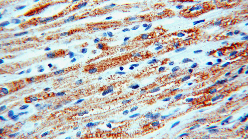 Immunohistochemical of paraffin-embedded human heart using Catalog No:115327(SLC25A20 antibody) at dilution of 1:100 (under 40x lens)