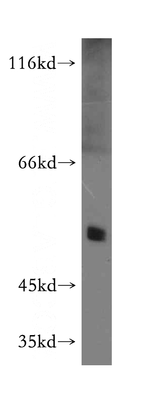 mouse heart tissue were subjected to SDS PAGE followed by western blot with Catalog No:114084(PPARD antibody) at dilution of 1:500