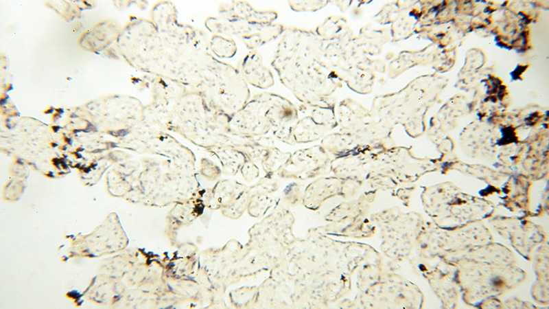 Immunohistochemical of paraffin-embedded human placenta using Catalog No:114019(PM20D2 antibody) at dilution of 1:50 (under 10x lens)
