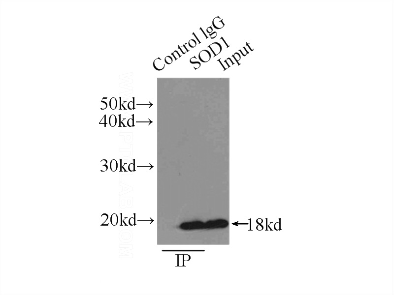 IP Result of anti-SOD1 (IP:Catalog No:115492, 3ug; Detection:Catalog No:115492 1:1500) with HEK-293 cells lysate 1000ug.
