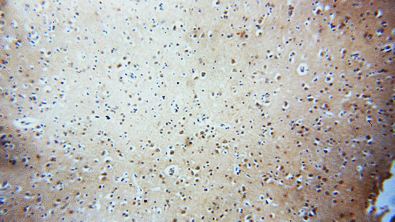 Immunohistochemical of paraffin-embedded human brain using Catalog No:116933(ZCCHC11 antibody) at dilution of 1:50 (under 10x lens)