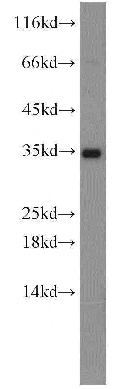 human placenta tissue were subjected to SDS PAGE followed by western blot with Catalog No:111683(IGFBP1 antibody) at dilution of 1:300