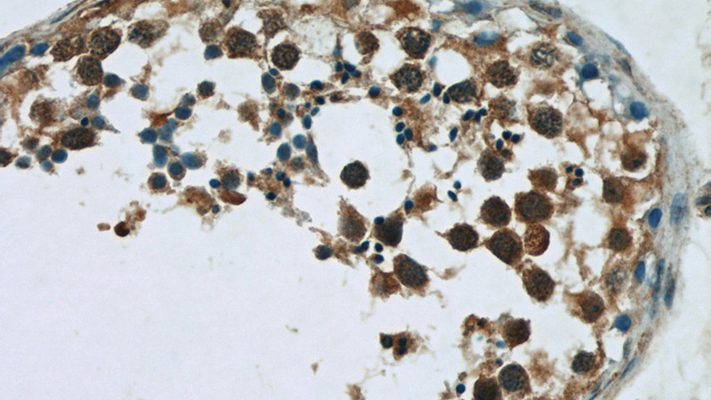 Immunohistochemistry of paraffin-embedded human testis tissue slide using Catalog No:108010(PRKAG1 Antibody) at dilution of 1:50 (under 40x lens)