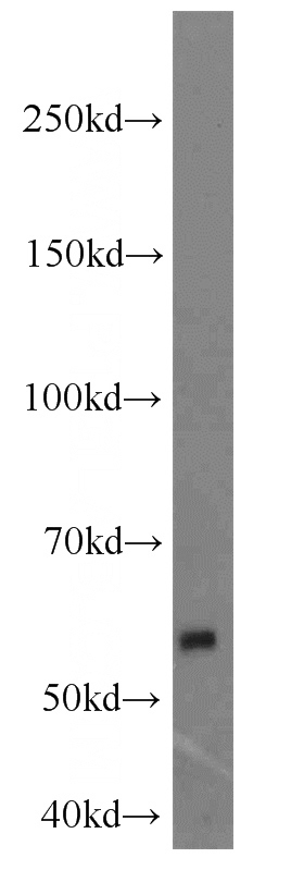 Y79 cells were subjected to SDS PAGE followed by western blot with Catalog No:112535(MGAT1 antibody) at dilution of 1:1000