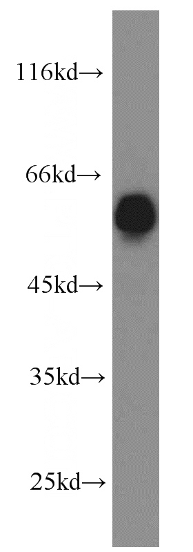HEK-293 cells were subjected to SDS PAGE followed by western blot with Catalog No:114227(PRPF19 antibody) at dilution of 1:500