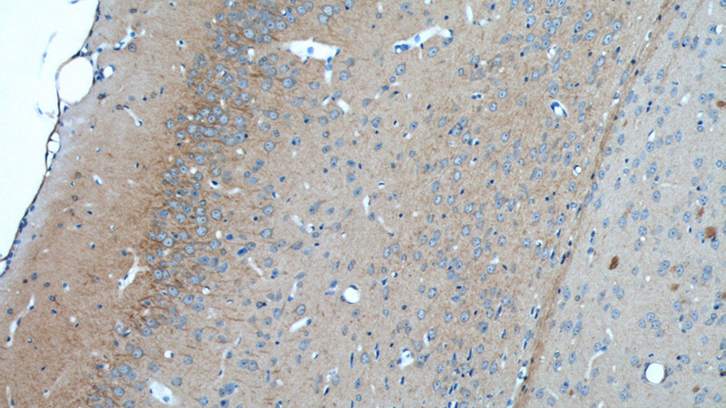 Immunohistochemistry of paraffin-embedded mouse brain tissue slide using Catalog No:108766(CACNG2 Antibody) at dilution of 1:50 (under 10x lens)