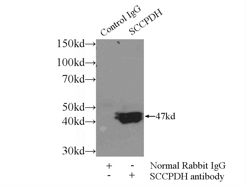 IP Result of anti-SCCPDH (IP:Catalog No:114988, 3ug; Detection:Catalog No:114988 1:300) with COLO 320 cells lysate 1700ug.