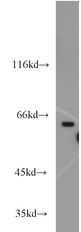PC-3 cells were subjected to SDS PAGE followed by western blot with Catalog No:108143(APLF antibody) at dilution of 1:600