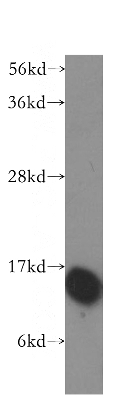 HEK-293 cells were subjected to SDS PAGE followed by western blot with Catalog No:111351(HINT1 antibody) at dilution of 1:400