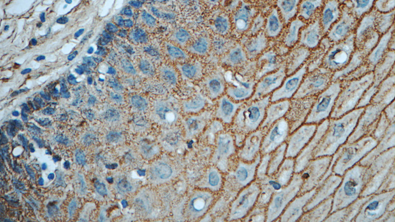Immunohistochemistry of paraffin-embedded human cervix tissue slide using Catalog No:110984(GJB3 Antibody) at dilution of 1:50 (under 40x lens)