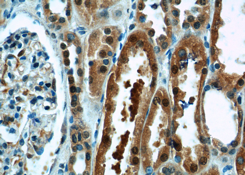 Immunohistochemistry of paraffin-embedded human kidney tissue slide using Catalog No:115887(TBX18 Antibody) at dilution of 1:50 (under 40x lens)
