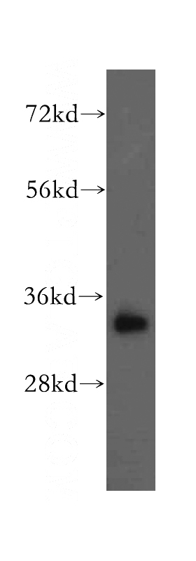 human heart tissue were subjected to SDS PAGE followed by western blot with Catalog No:112815(MRPL19 antibody) at dilution of 1:500