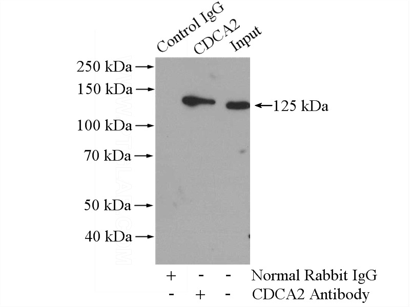 IP Result of anti-CDCA2 (IP:Catalog No:109113, 4ug; Detection:Catalog No:109113 1:800) with Jurkat cells lysate 2800ug.