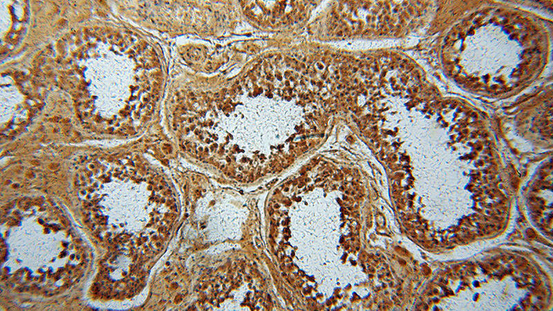 Immunohistochemical of paraffin-embedded human testis using Catalog No:115619(SSX4 antibody) at dilution of 1:50 (under 10x lens)