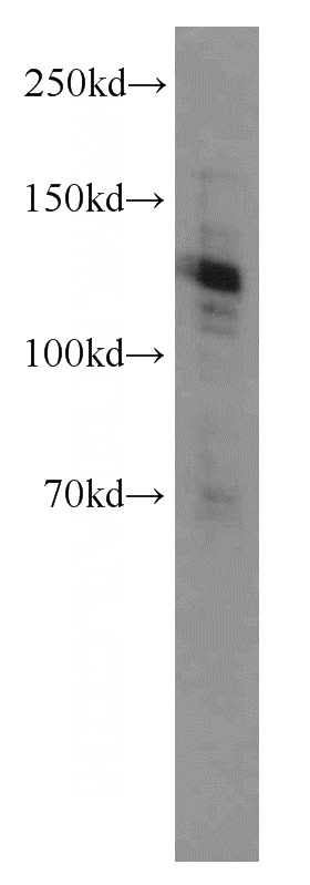 HeLa cells were subjected to SDS PAGE followed by western blot with Catalog No:108855(CARD14 antibody) at dilution of 1:500