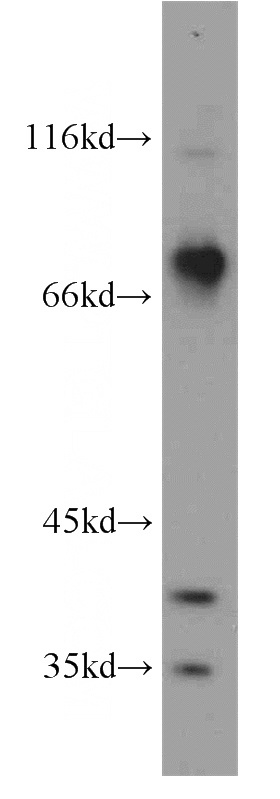 human brain tissue were subjected to SDS PAGE followed by western blot with Catalog No:108375(BBS7 antibody) at dilution of 1:1500