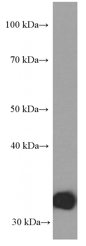 HEK-293 cells were subjected to SDS PAGE followed by western blot with Catalog No:107058(ANXA5 Antibody) at dilution of 1:1000