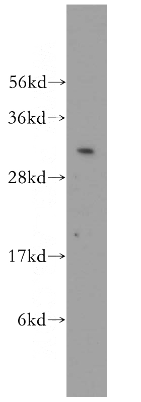 PC-3 cells were subjected to SDS PAGE followed by western blot with Catalog No:110410(EXOSC3 antibody) at dilution of 1:400