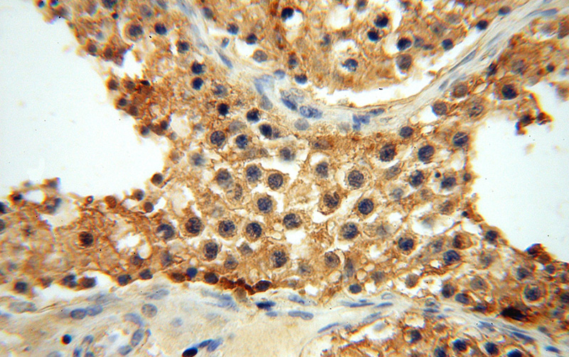 Immunohistochemical of paraffin-embedded human testis using Catalog No:109783(CYTL1 antibody) at dilution of 1:100 (under 40x lens)