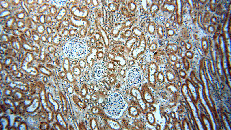 Immunohistochemical of paraffin-embedded human kidney using Catalog No:113921(PKNOX2 antibody) at dilution of 1:50 (under 10x lens)