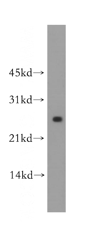mouse lung tissue were subjected to SDS PAGE followed by western blot with Catalog No:112397(LXN antibody) at dilution of 1:500