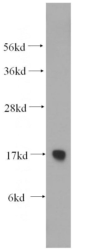 human liver tissue were subjected to SDS PAGE followed by western blot with Catalog No:114830(RPS15 antibody) at dilution of 1:500