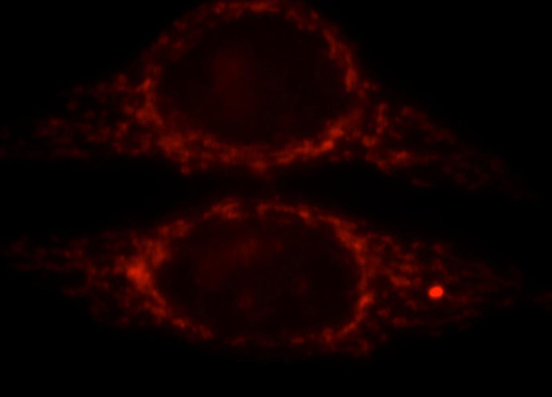 Immunofluorescent analysis of HepG2 cells, using CPS1 antibody Catalog No:109522 at 1:25 dilution and Rhodamine-labeled goat anti-rabbit IgG (red).
