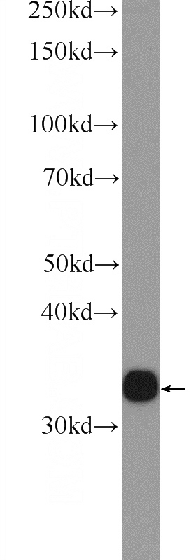 mouse liver tissue were subjected to SDS PAGE followed by western blot with Catalog No:107944(AKR1D1 Antibody) at dilution of 1:600